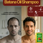 Shampoo Gypsophila Batana Oil Con extracto de Romero 300ml